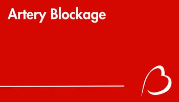 Play YouTube Video - Artery Blockage