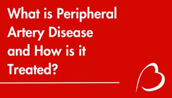 Play YouTube Video - What is Peripheral Artery Disease and How is it Treated?