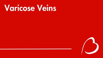 Play YouTube Video - Varicose Veins